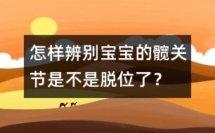 怎樣辨別寶寶的髖關(guān)節(jié)是不是脫位了？
