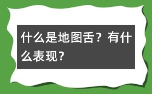 什么是地圖舌？有什么表現(xiàn)？