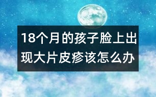 18個月的孩子臉上出現(xiàn)大片皮疹該怎么辦――宋善路回答