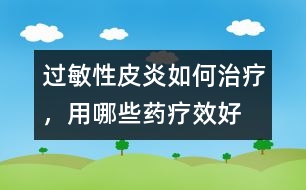 過敏性皮炎如何治療，用哪些藥療效好
