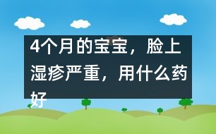 4個(gè)月的寶寶，臉上濕疹嚴(yán)重，用什么藥好