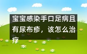 寶寶感染手口足病且有尿布疹，該怎么治療