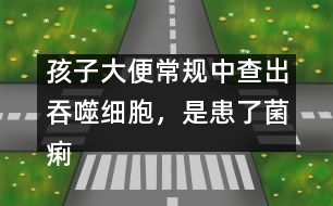 孩子大便常規(guī)中查出吞噬細(xì)胞，是患了菌痢