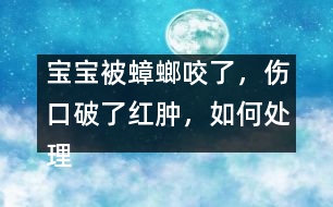 寶寶被蟑螂咬了，傷口破了紅腫，如何處理