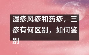 濕疹風(fēng)疹和藥疹，三疹有何區(qū)別，如何鑒別