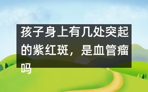 孩子身上有幾處突起的紫紅斑，是血管瘤嗎