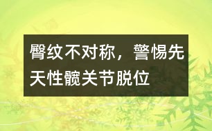 臀紋不對稱，警惕先天性髖關(guān)節(jié)脫位