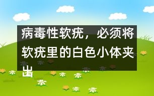 病毒性軟疣，必須將軟疣里的白色小體夾出
