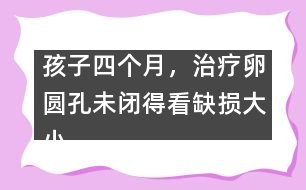 孩子四個月，治療卵圓孔未閉得看缺損大小